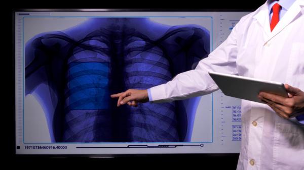 50.000 de români mor anual bolnavi de cancer. În unele judeţe sunt numai 3 oncologi