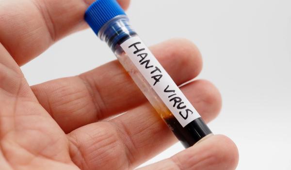 Cum se transmite hantavirusul? Medicul Adrian Marinescu explică diferenţele faţă de coronavirus