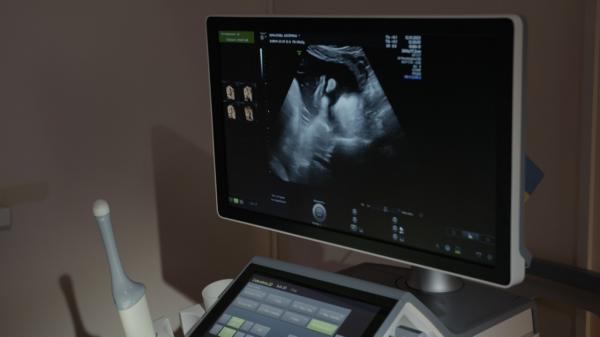 Spina bifidă și hidrocefalia la bebeluși: cum pot fi diagnosticate înainte de naștere