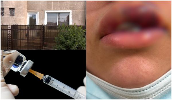 Şi-a făcut cadou de majorat injecţii cu acid şi era să îşi piardă buza. Salvată în ultima clipă
