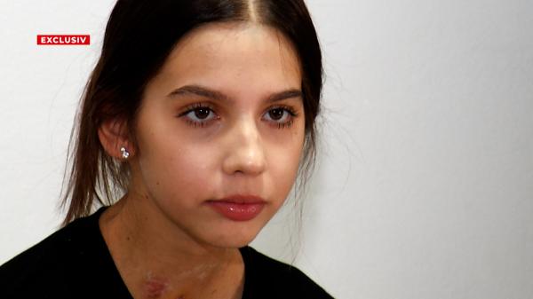Miruna, fata salvată cu ECMO după ce a luat leptospiroză la festival, şi-a revenit. Vrea să devină medic