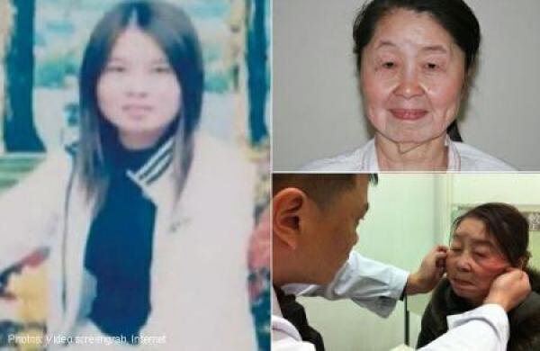 O chinezoaică suferă de o boală rară care o face să pară mai bătrână cu 40 de ani