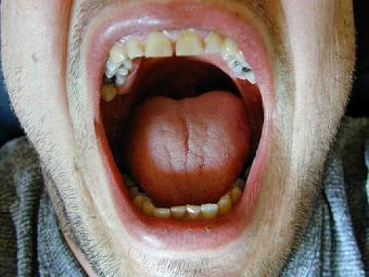 VIDEO! Medicii au rămas BLOCAȚI când i-au examinat gura: „Este o anomalie EXTREM de rară!”