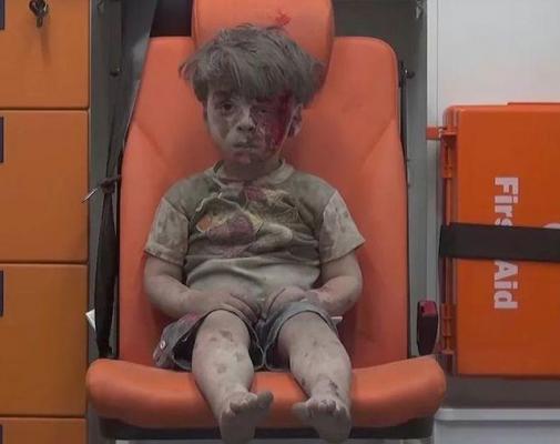 IMAGINILE care te vor impresiona până la lacrimi. El este "Băiatul din ambulanţă", noul simbol al victimelor războiului (VIDEO)