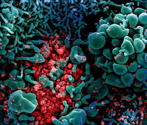 OMS, avertisment dur: Pandemia de coronavirus este departe de a se încheia