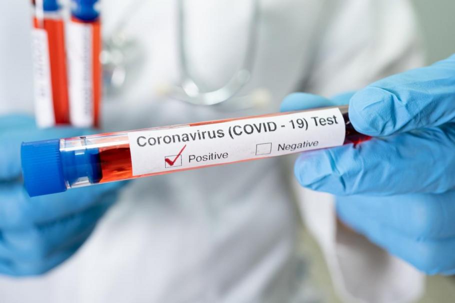 Bilanț coronavirus în România, 16 ianuarie. Peste 7.500 de cazuri și 28 de decese, în ultimele 24 de ore