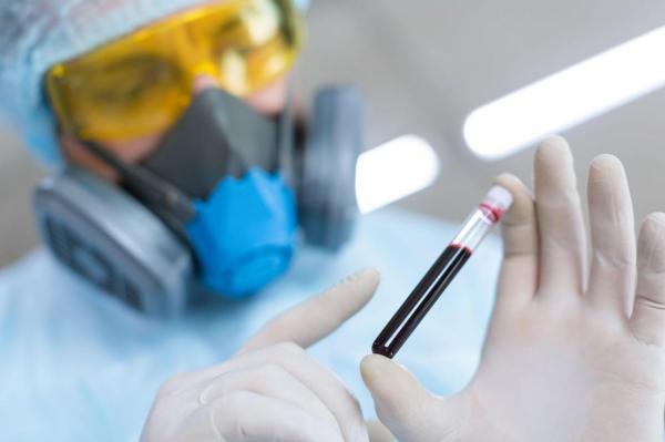 Moderna a început testele pentru un vaccin împotriva HIV, bazat pe tehnologia ARN mesager