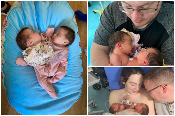 Naşterea fetiţelor, un "miracol" pentru părinţi