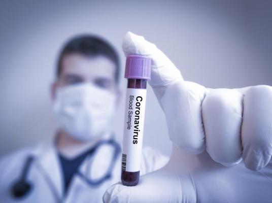 Test pentru depistarea coronavirus
