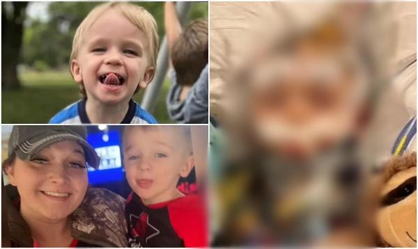 Băiețel de 3 ani, între viață și moarte după ce a fost bătut cu o curea de un copil de 12 ani, în SUA. Micuțul, lovit cu brutalitate pentru că plângea