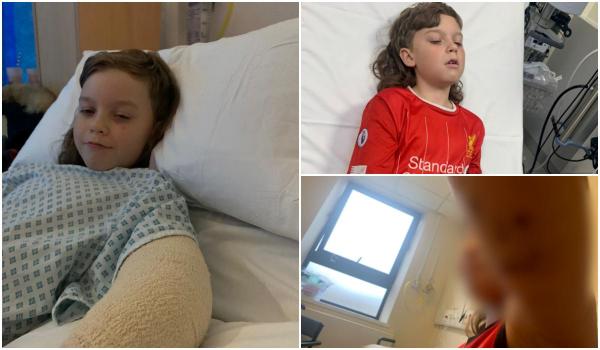 Un băiat de 10 ani, sfâșiat de un câine în timp ce se juca fotbal, în UK