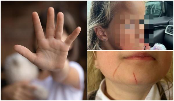 O fetiță de 6 ani s-a întors de la școală bătută și cu părul tăiat, în UK
