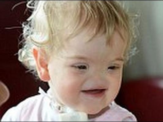 Video SFÂŞIETOR! Fetiţa care s-a născut fără nas şi totuşi zâmbeşte neîncetat