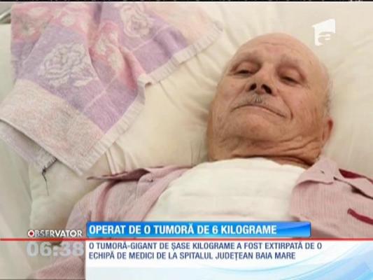 Un bătrân de 86 de ani a trecut printr-o intervenţie în premieră la Baia Mare. Medicii i-au extirpat o tumoră uriaşă, de şase kilograme