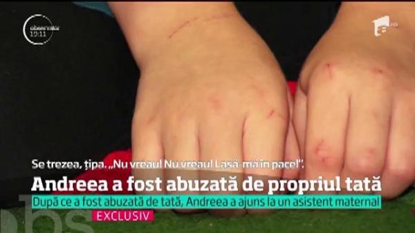 Campania Observator "Eu pentru ce m-am născut?" La doar 5 ani, Andreea, din Iași, a fost abuzată de propriul tată