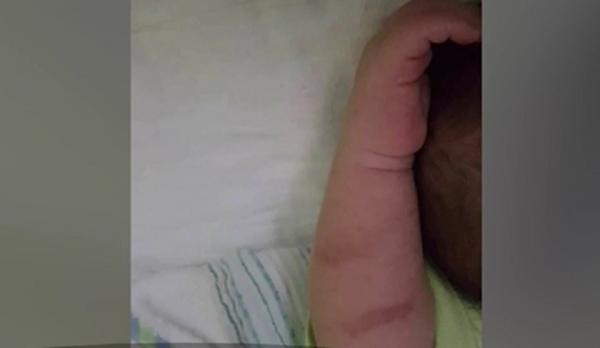 Bebeluş de doar trei săptămâni, învinețit de medici la ambele braţe! Au încercat să îi pună o branulă timp de 30 de minute!
