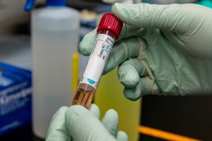 Noua tulpină de SARS-Cov-2, mult mai contagioasă, confirmată la tânăra testată la Institutul Matei Balș
