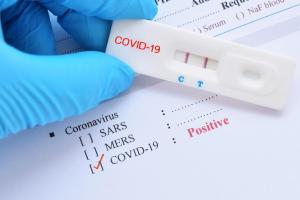 Bilanț coronavirus în România, 10 martie. 4.564 cazuri și 100 morți, în ultimele 24 de ore