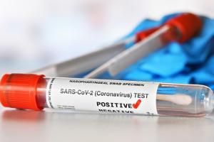Bilanț coronavirus în România, 10 septembrie. Peste 2.500 de cazuri noi și 41 de decese, în ultimele 24 de ore