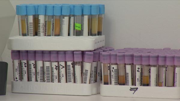 Medicii lămuresc problema testului de anticorpi: este sau nu necesar înainte de a treia doza?