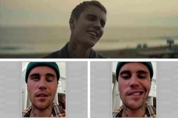 Mesaj cutremurător publicat de Justin Bieber: "Am paralizie completă pe jumătate din faţă"