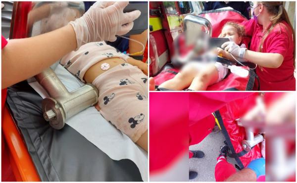 Chirurgii din Iaşi, ajutaţi de mecanici la dezasamblarea maşinii de tocat care i-a prins mâna fetiţei de 4 ani