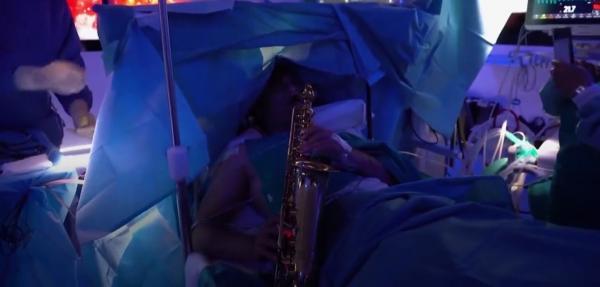Un muzician italian a cântat la saxofon timp de 9 ore, în timp ce era operat pe creier: a fost supus unei "operații în stare de veghe"