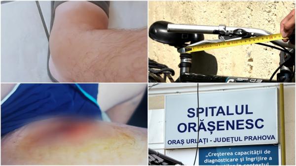 Tânărul căruia un medic din Prahova i-a cusut frâna bicicletei în picior povesteşte cum a fost salvat în Olanda. "Am rămas şocaţi toţi"