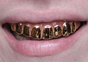 In Arges, oamenii isi amaneteaza dintii de aur, pentru a face rost de bani!