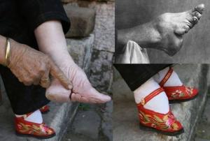 Cruzime cum nu aţi mai văzut! Idealul de frumuseţe al picioarelor mutilate din China