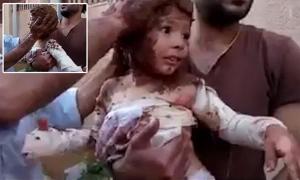 Imagini EMOŢIONANTE: O fetiţă de câţiva anişori, unsă cu nămol pe rănile şi arsurile provocate de atacurile din Siria (FOTO)