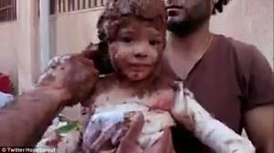 Imagini EMOŢIONANTE: O fetiţă de câţiva anişori, unsă cu nămol pe rănile şi arsurile provocate de atacurile din Siria (FOTO)