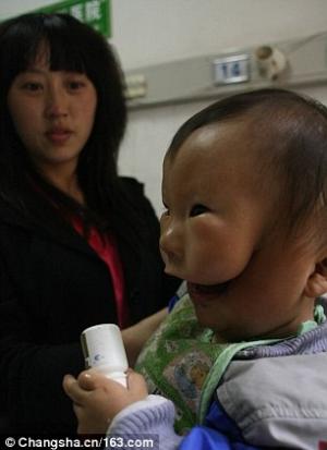 Medicii chinezi caută soluții pentru a da o șansă unui copil născut cu o malformație rară