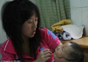 Medicii chinezi caută soluții pentru a da o șansă unui copil născut cu o malformație rară