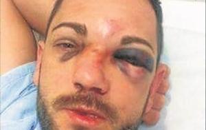 Român bătut cu sălbăticie într-un club din Spania. L-au mutilat alţi 15 români, care l-ar fi atacat fără motiv (FOTO)
