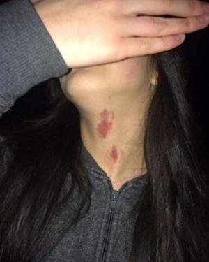 Ce imagini posta pe reţelele de socializare adolescenta din Sibiu care s-a sinucis jucând BALENA ALBASTRĂ