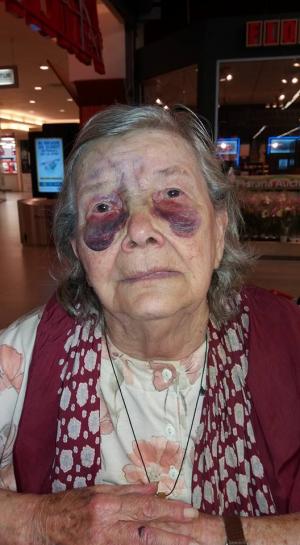IMAGINI ŞOCANTE! O bătrână a fost snopită în bătaie de propria familie: 'Inuman, ruşinos şi strigător la cer!'