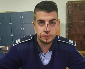 Poliţist SNOPIT ÎN BĂTAIE de un şofer băut! Tânărul de 25 de ani l-a UMPLUT DE SÂNGE pe agent, după ce a fost testat cu aparatul etilotest (GALERIE FOTO)