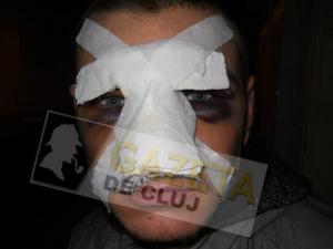 Un fost militar din Legiunea Străină a fost rupt în bătaie de bodyguarzii unui club din Cluj: 'M-am trezit culcat la pământ din câţiva pumni' (Foto)