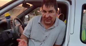 Muncitor român în Italia, bătut cu bestialitate de 7 bărbați după ce le-a cerut să nu arunce sacii cu gunoi într-un parc