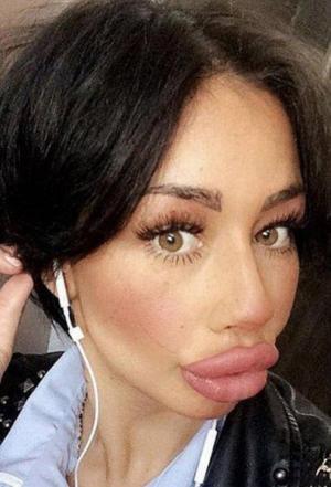 Selfie cu "buzele de rață", noua modă pe rețelele de socializare