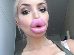 Selfie cu "buzele de rață", noua modă pe rețelele de socializare