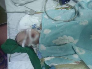 A murit bebeluşul internat cu bronşită la spitalul din Oradea. Părinţii acuză că fiul lor ar fi luat rujeolă de la alt copil