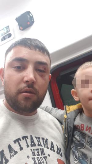Copil de trei ani gazat de agenţii unei firme de pază din Caracal, care i-au bătut tatăl pe stradă