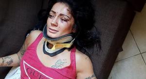 Tânără dansatoare româncă, bătută crunt în Italia. Alexandra a fost lovită fără milă de mai mulţi bărbaţi