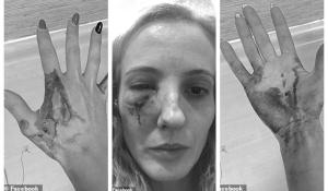 Mamă româncă din Anglia, bătută fără milă de 10 tineri: 'Ieşi acasă în Polonia'