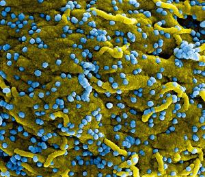 Cum arată o tulpină de coronavirus la microscopul cu electroni