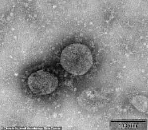 Primele imagini cu virusul ucigaş din China. Numărul oamenilor infectaţi aproape s-a dublat în 24 de ore