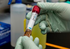 Noua tulpină de SARS-Cov-2, mult mai contagioasă, confirmată la tânăra testată la Institutul Matei Balș