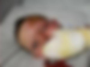 Un copil de 4 ani a fost grav rănit într-o explozie a unei butelii, provocată chiar de tată. Bărbatul a vrut să se răzbune pe soţia care divorţase, în Crimeea